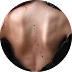 Body Freckles