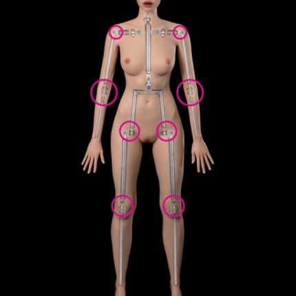 Limb Weakness