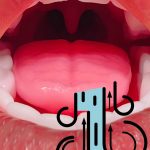 Oral Heating