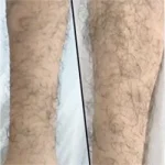 Arm Hair