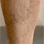 Leg Hair