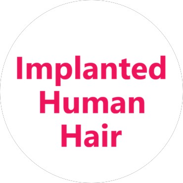 Implanted Human Hair