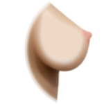 Gel-Filled Breast