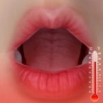 Oral Heating