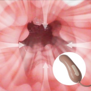 Oral Auto-Sucking