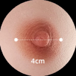4CM